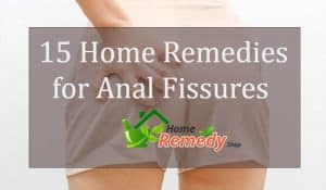 home remedies for anal fissures