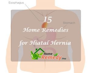 home remedies for hiatal hernia