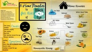HRS infographic about getting rid of a black eye at home