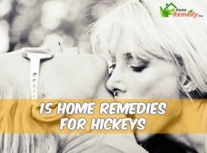 couple kissing caption home remedies for hickeys