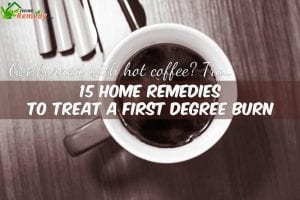 hot coffee on table caption home remedies for first degree burn