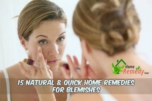 how to get rid of blemishes