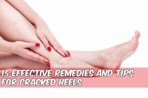 cracked heels with caption how to heal