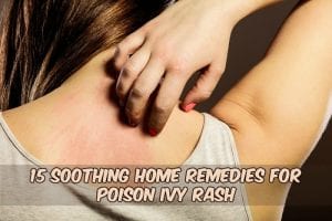 poison ivy rash