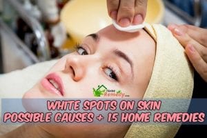 woman undergoing skin treatment