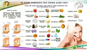 Looking for home solutions to fix acne fast before going out?