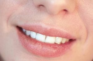 home remedies for dry lips