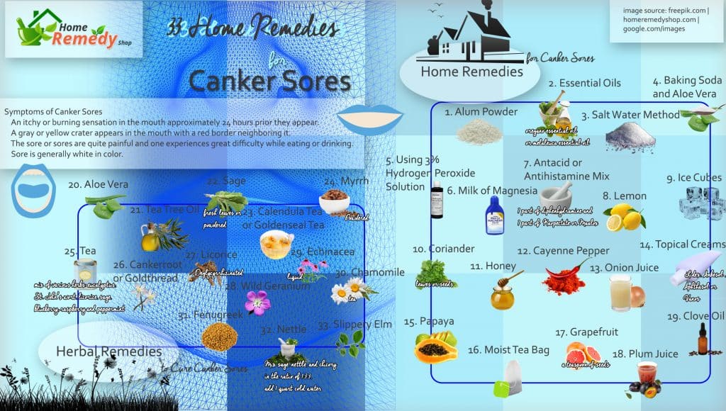 33 Home Remedies For Canker Sores Infographic Home Remedies 33 Home Remedies For Canker Sores Infographic Home Remedies