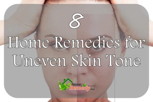 8 Home Remedies for Uneven Skin Tone - Home Remedies