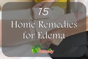 home remedies for edema