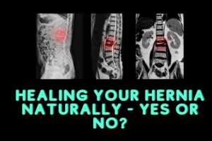 home remedies for hernia