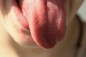 tongue
