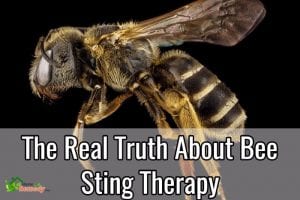 bee sting therapy