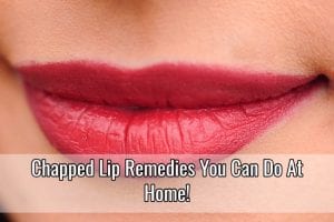 chapped lips
