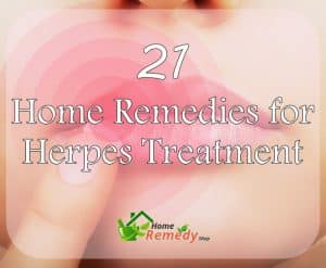 Girl holding a finger to her lips with a herpes sore