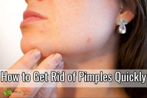 how to get rid of pimples