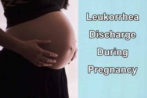 leukorrhea