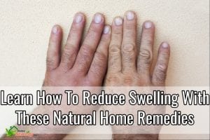 how to reduce swelling