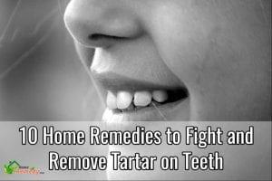 tartar on teeth