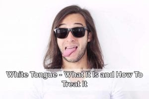 white tongue